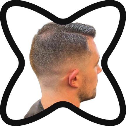 skin fade
